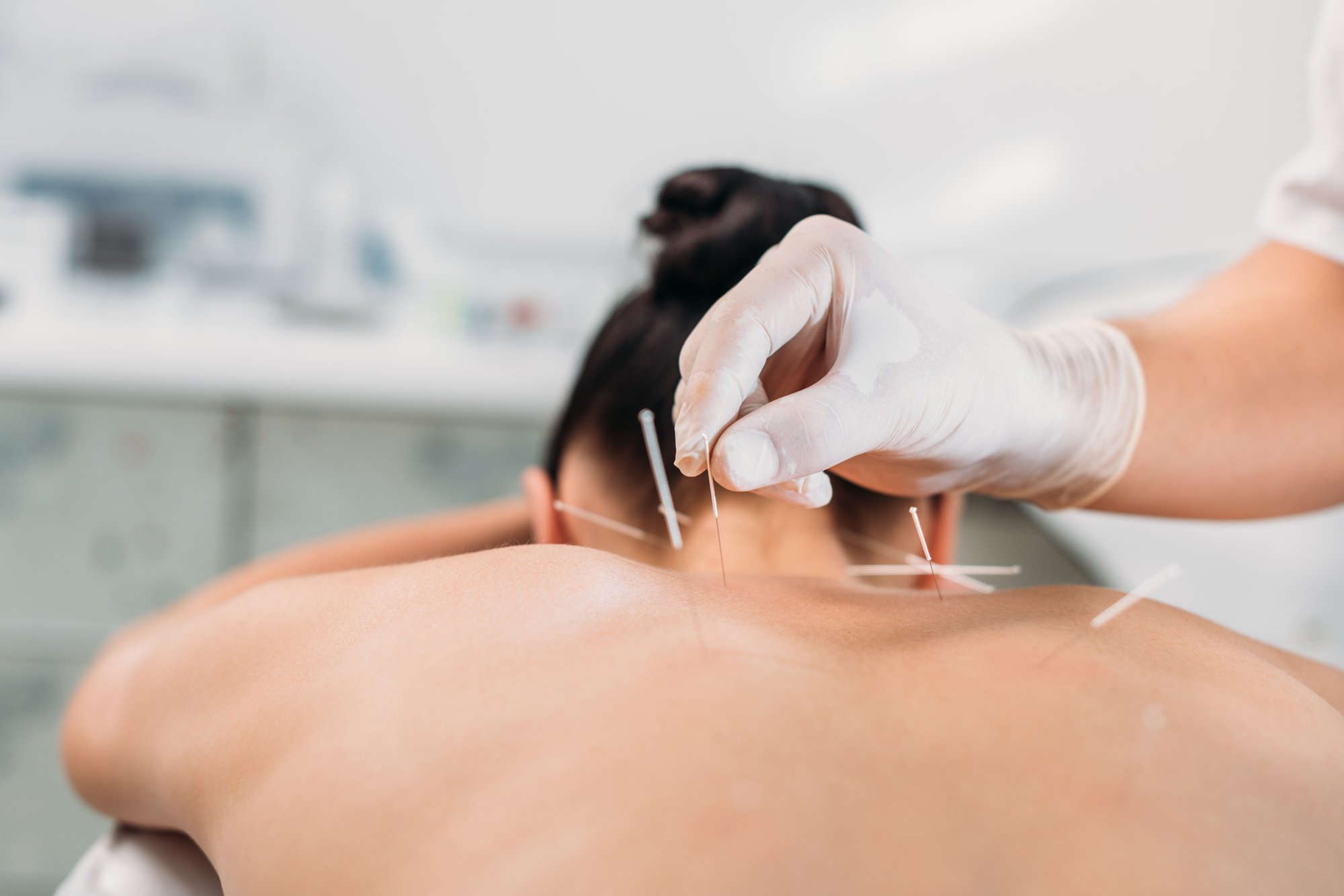 Dry Needling PT